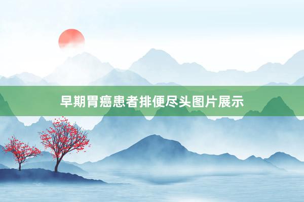 早期胃癌患者排便尽头图片展示
